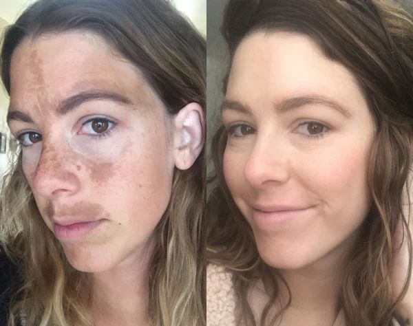 Before After Results